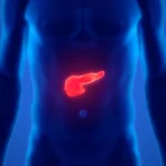 Un vaccin contre le cancer du pancréas ouvre une nouvelle ère de traitement