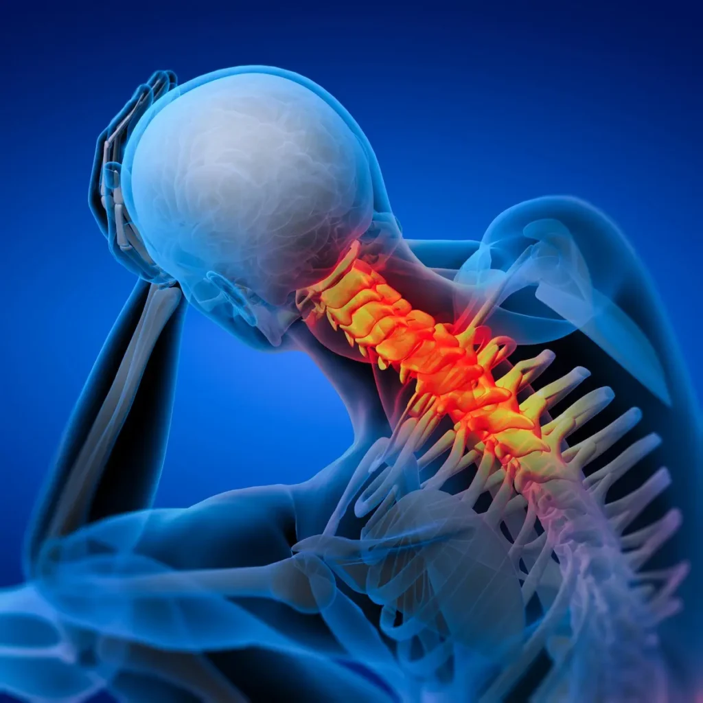 Quand les douleurs cervicales déclenchent vos migraines : 5 gestes simples pour apaiser la tension
